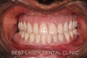 GET FIXED TEETH AND CONFIDENT SMILE