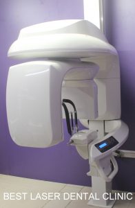 cbct in dental implants